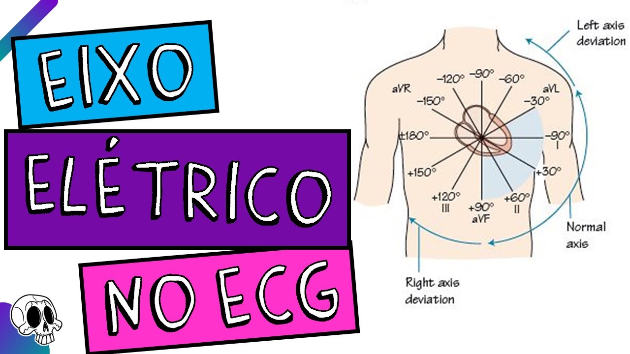 Eixo elétrico no ECG