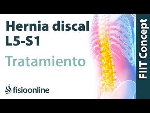Chirurgia artrodesi della caviglia Dolore alle articolazioni e le ossa