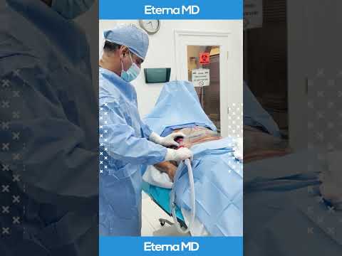 Colombian Liposculpture | Eterna M.D. Medical...