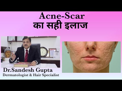 Dermatologist in Delhi..drsandeshgupta.com