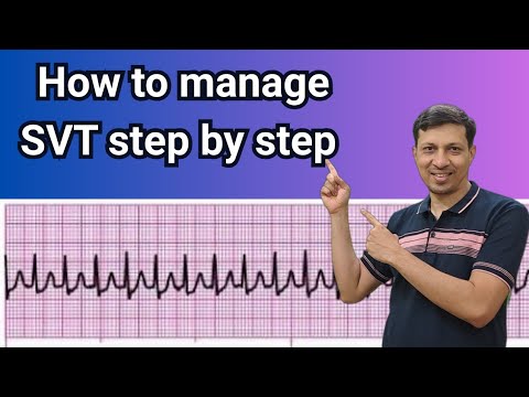 How to Manage Supraventricular Tachycardia (SVT) Step by Step | 