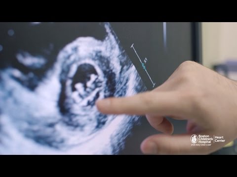 Cardiomyopathy in children: What you should know | Boston Children's Hospital Heart Center