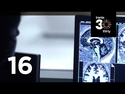 30/30: L’imagerie cérébrale