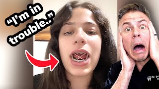 Download lagu NEVER Make This Braces RubberBands Mistake! mp3