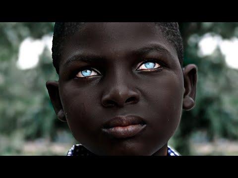 The 11 Weirdest Black Children in the World