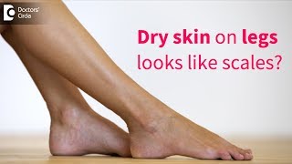 Great tips to get rid of very dry flaky skin on legs  - Dr. Rasya Dixit | Doctors