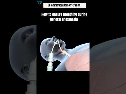 How to ensure Breathing During General Anesthesia #shorts​ #viral​ #trending​