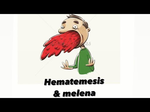 Clinical round 5- hematemesis and melena