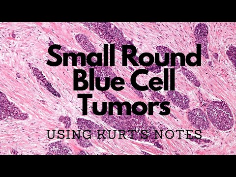 Small Round Blue Cell Tumor Ddx: Using Kurt’s Notes #pathagonia