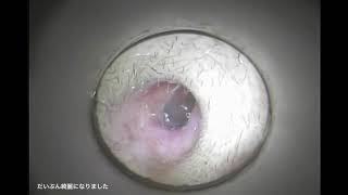 耳掃除動画 番外編 お客様がお持ち帰り動画を投稿 「イヤーエステに行ってみた~右耳編~」