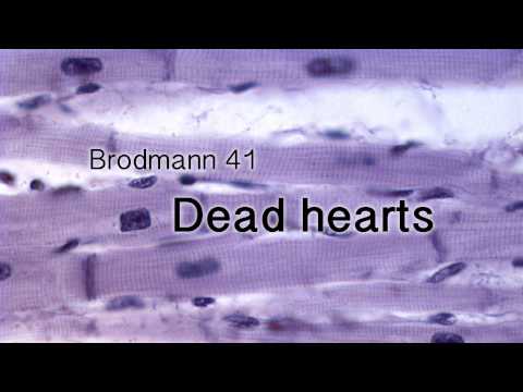 Brodmann 41 - Dead hearts