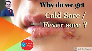 Cold Sores - Why? | Fever Blisters
