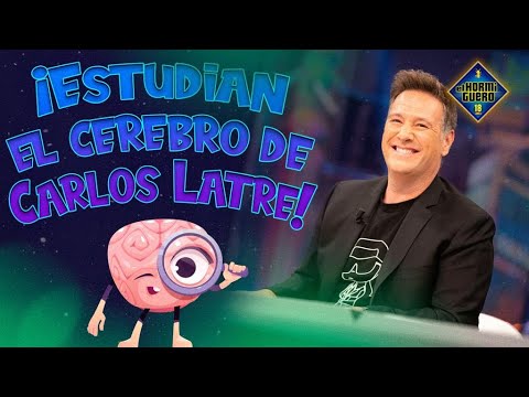 El cerebro de Carlos Latre a estudio - El Hormiguero