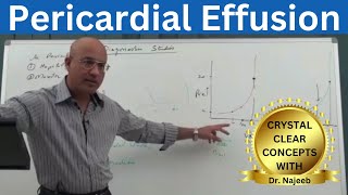 Pericardial Effusion | Pericardium | Cardiology🫀