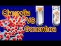 Chlamydia vs Gonorrhea: Key Differences Explained