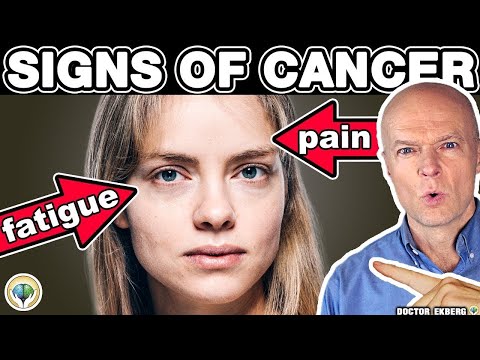 10 Warning Signs of Cancer You Should Not Ignore