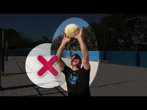 Setting as an Attack Hit- Beach Volleyball-LIVE EXAMPLE