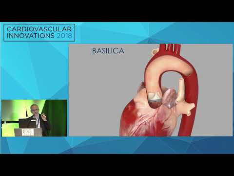 CVI2018 Session: Techniques to optimize transcatheter aortic therapy - Adam Greenbaum, MD