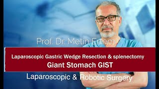 Miniaturka - Laparoscopic gastric wedge resection & splenectomy. Giant Stomach GIST. metin Ertem MD.FACS