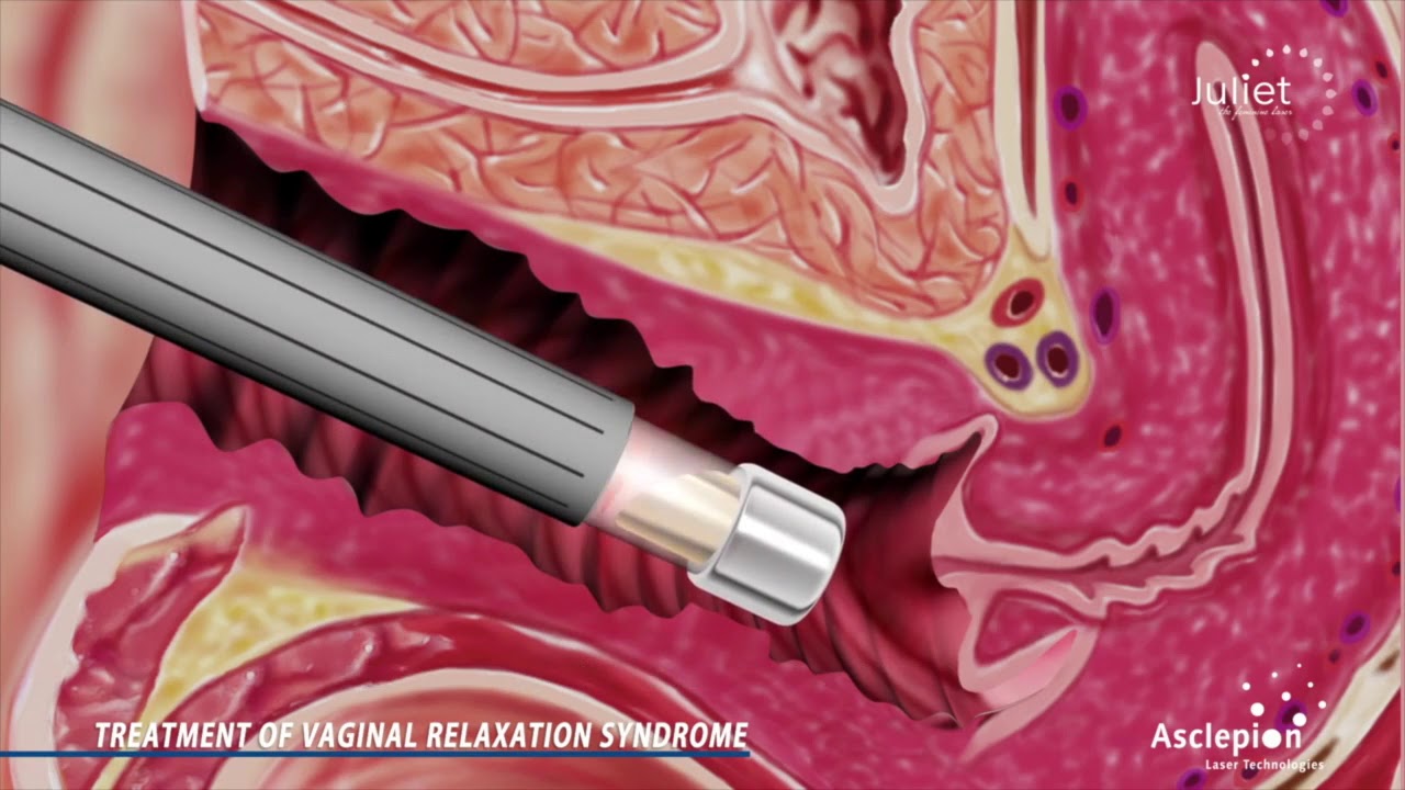 Diana Luna Guerrero-14