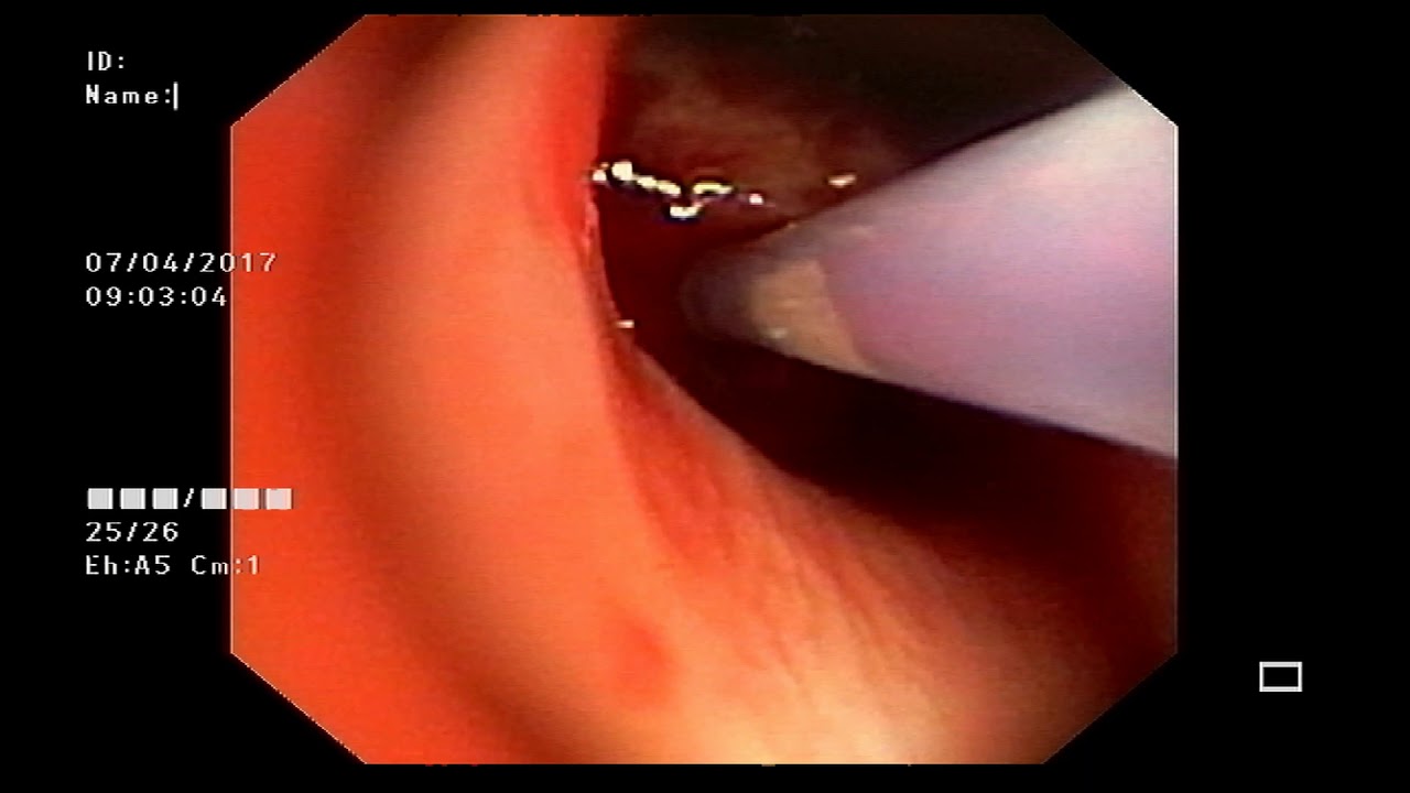 Fermín Alejandro Rojas Cisneros-4