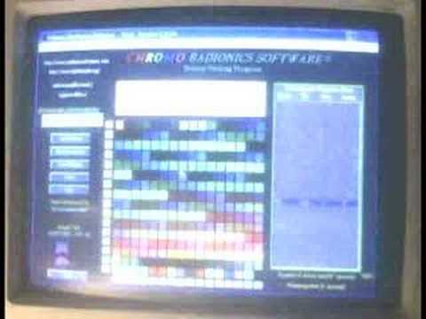 download lagu mp3 mp4 Radionics Software Download, download lagu Radionics Software Download gratis, unduh video klip Radionics Software Download