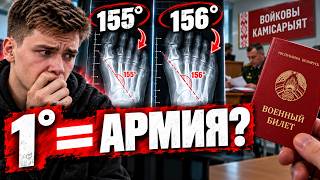 Плоскостопие и армия: почему после ВОЕННОГО БИЛЕТА могут снова признать годным