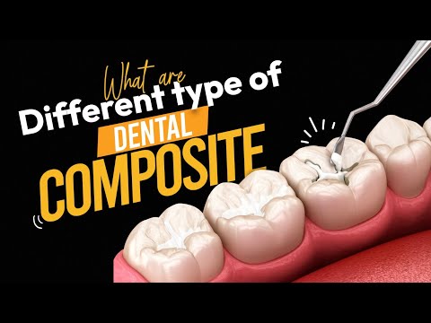 What are Different Types of Dental Composites? | Dentalkart