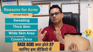 What is back acne? | Causes of back acne | Body Acne | All about acne | Dr. Jangid