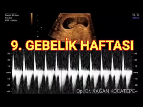 Anne karnında 8 haftalık bebek nasıl görünür? (9. gebelik haftasında ultrason)