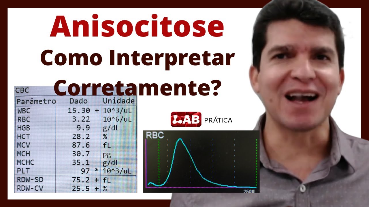 ANISOCITOSE - Como Interpretar Corretamente?