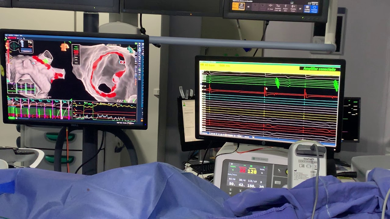 Karim Yarek Juarez Escobar-15