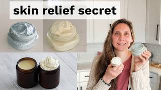 Does Tallow Help Eczema?
