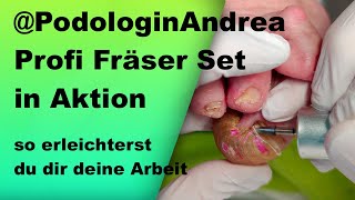 Das Podologin Andrea Profi-Fräseset - Anwendungsvideo