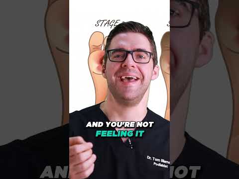 20 Ways To Get Rid of Toenail Fungus Proven CURE Home Remedies