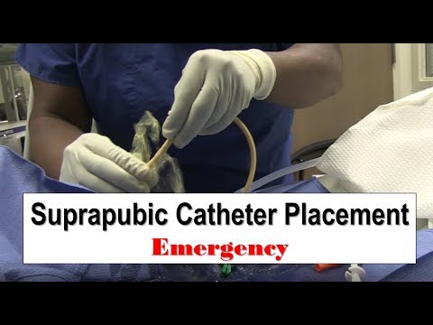  Suprapubic Catheter Placement