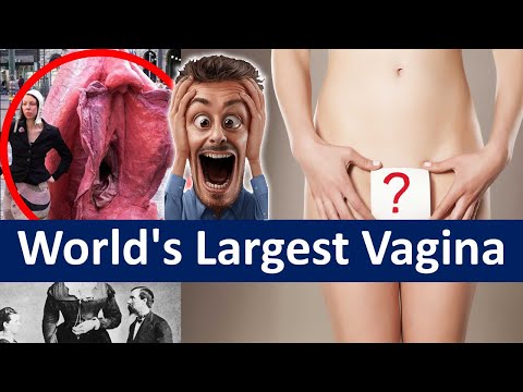 World's Largest Vagina | Biggest Vagina