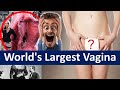 World S Largest Vagina Biggest Vagina