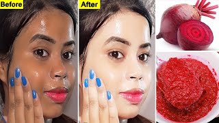 Beetroot face pack for smooth and glowing skin at home|De tanning remedy| beetroot powder