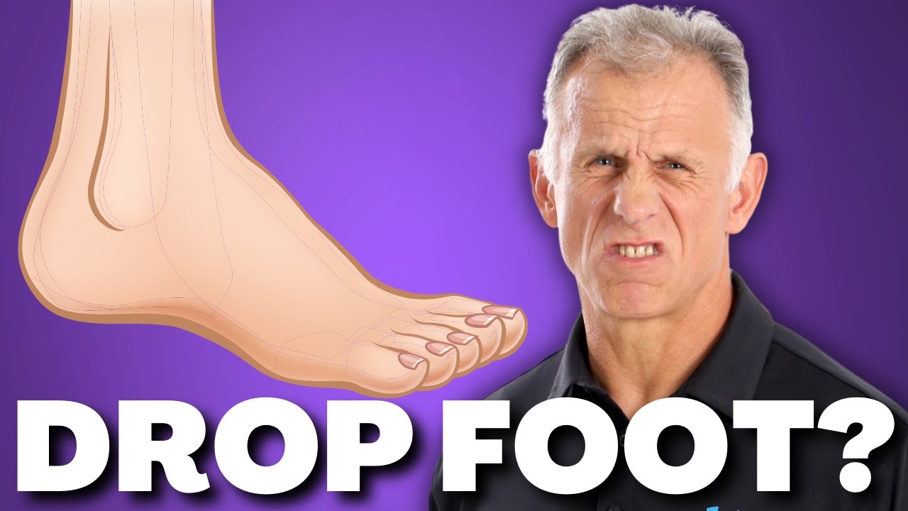 10 Exercises for Foot Drop after Stroke, Nerve, or Muscle Damage (Weak Ankle & Foot). - YouTube