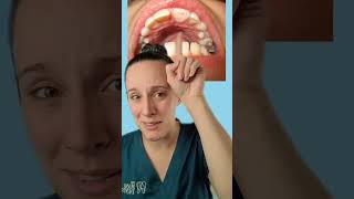#greenscreen Do you know what to do if you break a tooth? 🦷😬 #dentist #fyp