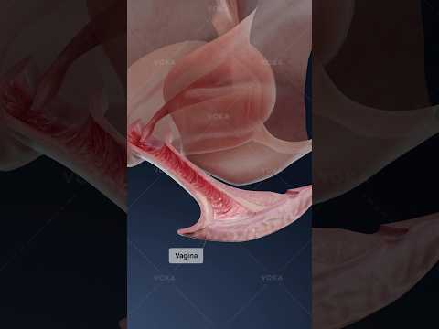 What is ATROPHIC VAGINITIS and how does it affect vaginal health? 3D visualization