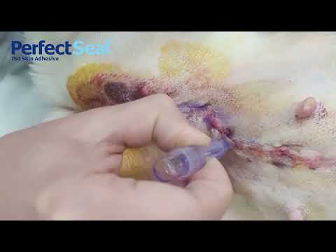 Adhesive tape, stitches, staples, zipper, glue: How to choose? - PerfectSeal