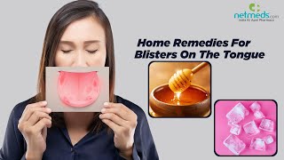 Blisters On The Tongue: 6 Effective Home Remedies