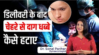 Pigmentation treatment on face | डिलीवरी के बाद चेहरे से दाग धब्बे कैसे हटाए | Sonal Parihar