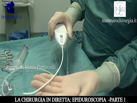 Che ha curato lernia intervertebrale senza chirurgia Agente per il trattamento dei giunti Podmore