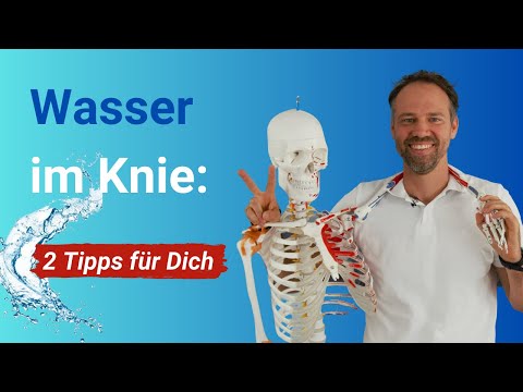 Warum schwillt mein Knie an? ➡️ 2 konkrete Tipps gegen Wasser im Arthrose-Knie