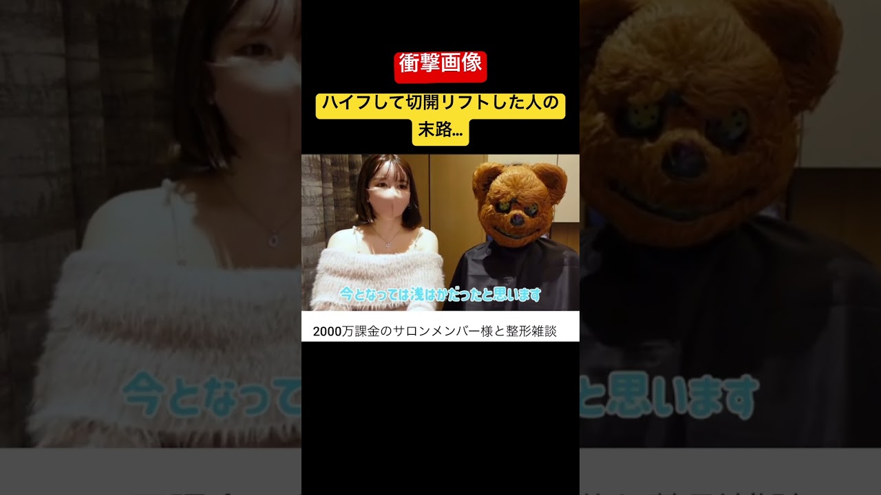 After HYFU and incision lift, my cheeks got sore... #shorts #surgery #cosmeticsurgery # #Rabichan