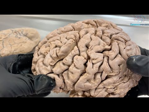 Anatomia do Encéfalo - com peça verdadeira!!!!