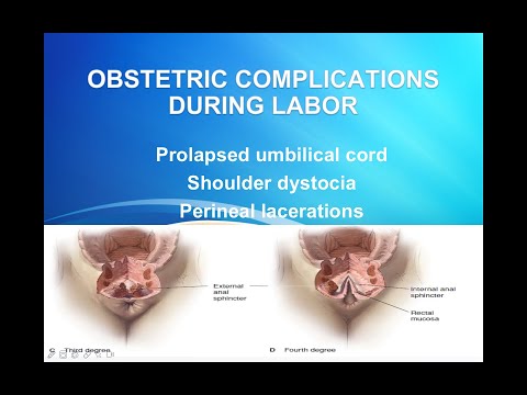 Obstetric complications during labor